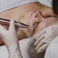 Microneedling: The Natural Way to Rejuvenate Your Skin